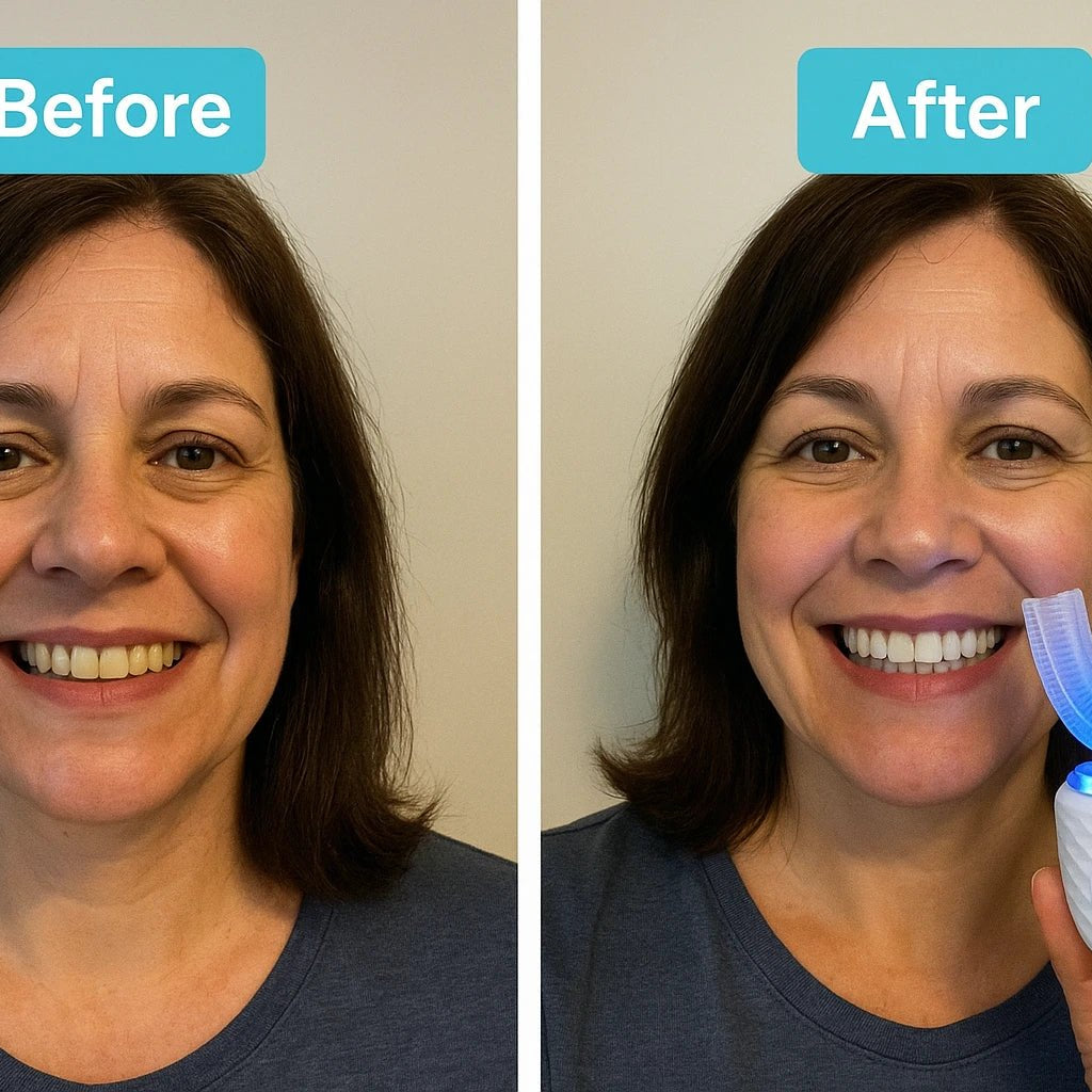 Smilebaltic Brush - 1 Best Selling Toothbrush - SMILEBALTIC